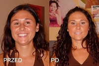 Przed i Po - Ce-Ce i Oaza Urody