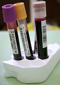 Zostań dawcą szpiku