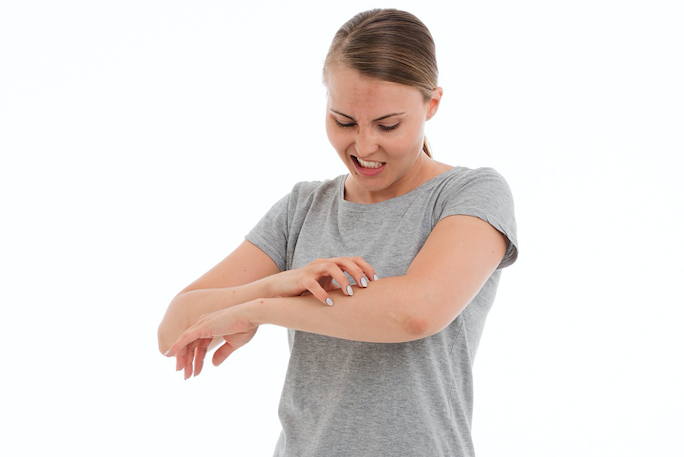 Bezpłatne konsultacje dermatologiczne dla pacjentów z pokrzywką idiopatyczną