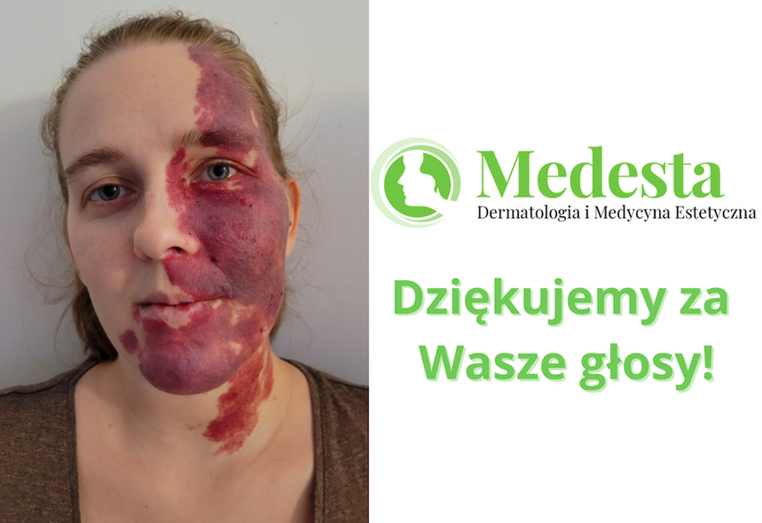 Laureatka konkursu z Medestą: "Jestem bardzo wzruszona"