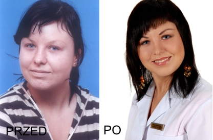 Elbląg, Pani Ula przed i po wykonaniu zabiegu trwałego makijażu.
