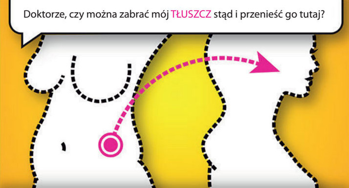 Przeszczepy tłuszczu i komórek macierzystych w Elblągu - bezpieczne odmładzanie