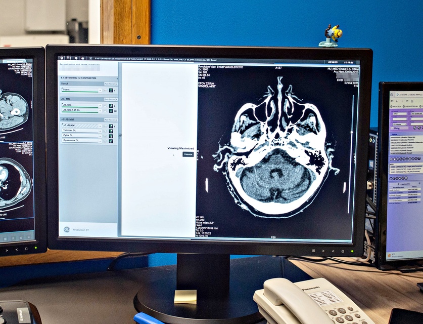 Pierwszy taki tomograf zdjęcie nr 337375