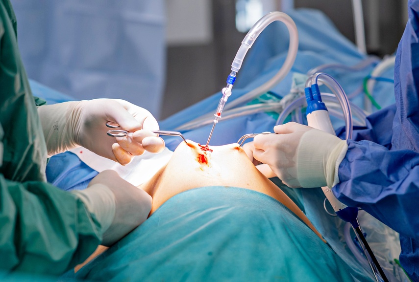 Elbląscy lekarze operują z robotem zdjęcie nr 344532