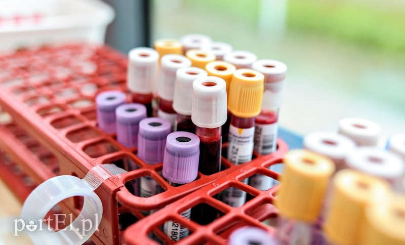  PortEl testuje: Utoczyliśmy sobie krwi zdjęcie nr 180482