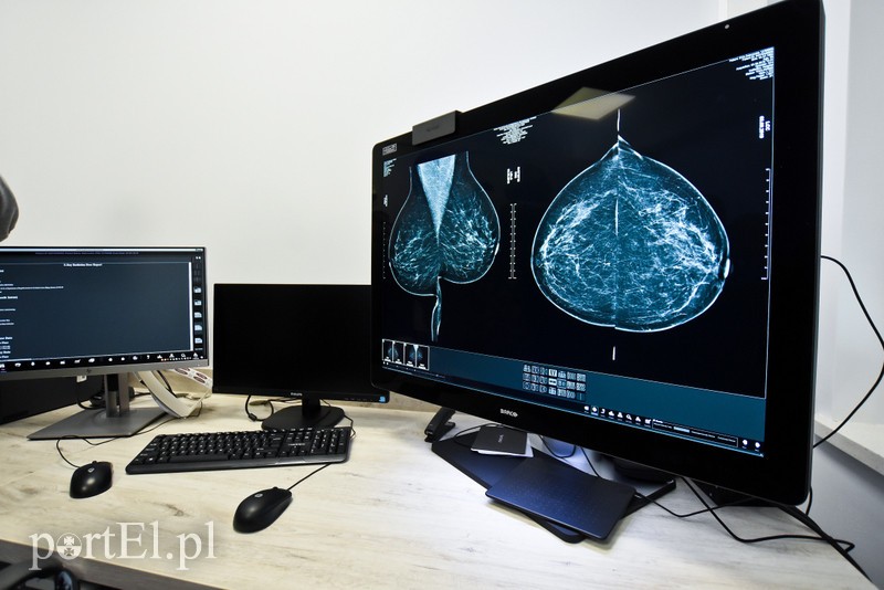 Pierś do przodu, idź się zbadać! zdjęcie nr 210588