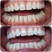 Upiększ_ONA. Wpadnij sobie w oko!