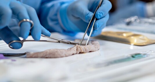 Roboty w służbie chirurgii