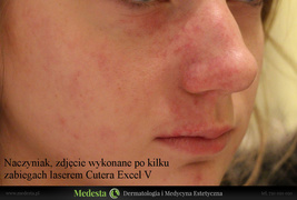 Rzeczywiste rezultaty zabiegów w Klinice Medesta