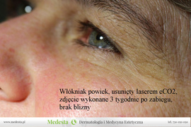 Rzeczywiste rezultaty zabiegów w Klinice Medesta