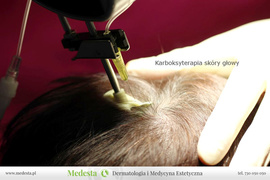 Współpraca kosmetologa i dermatologa estetycznego. Bony upominkowe