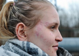 PortEl.pl testuje: Te zmiany muszą zniknąć!