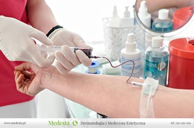 Najmocniejsze osocze bogatopłytkowe: na odrost włosów i odmłodzenie skóry